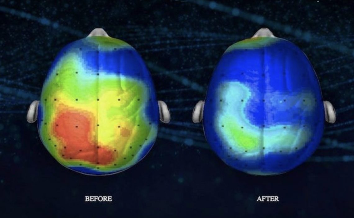 Neuroscientists Discover A Song That Can Reduce Anxiety By 65 Percent (Listen)